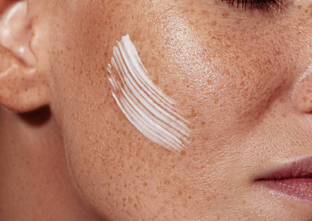 Close-up shot of female skin with freckles with white cream